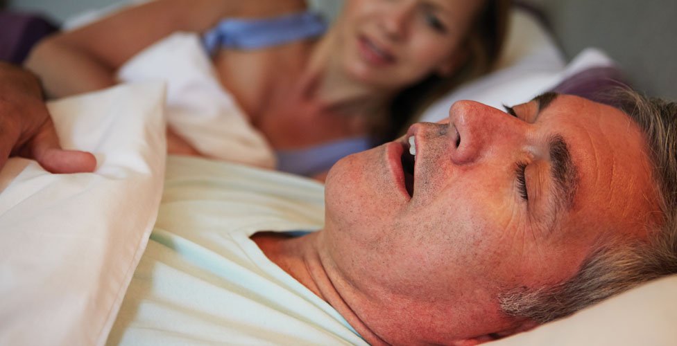 Sleep Apnea
